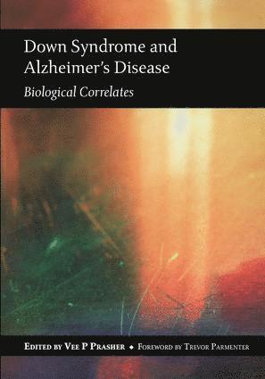 Down Syndrome and Alzheimer's Disease 1