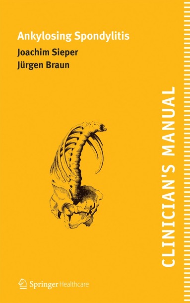 Joachim Sieper, Jürgen Braun, Joachim Sieper, Jürgen Braun - Clinician's Manual on Ankylosing Spondylitis, Häftad