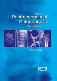 bokomslag Atlas of Postmenopausal Osteoporosis