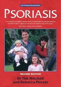 bokomslag Psoriasis 2e