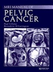 bokomslag Handbook of Mri Staging of Pelvic Cancer