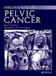 Handbook of Mri Staging of Pelvic Cancer 1