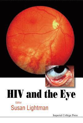 bokomslag HIV and the Eye