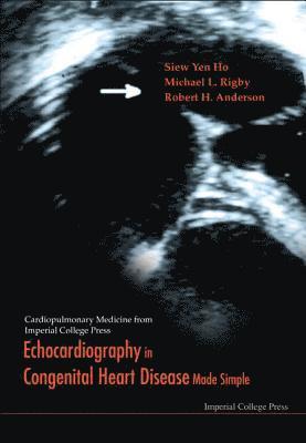 Robert Henry Anderson, Siew Yen Ho, A N Redington, Michael L Rigby, Uk) Anderson, Robert Henry (Univ Of College London, Uk) Ho, Siew Yen (Imperial College, Uk) Redington, A N (Imperial College, Uk) Rigby, Michael L (Royal Brompton Hospital, HO SIEW YEN - Echocardiography In Congenital Heart Disease Made Simple, Inbunden