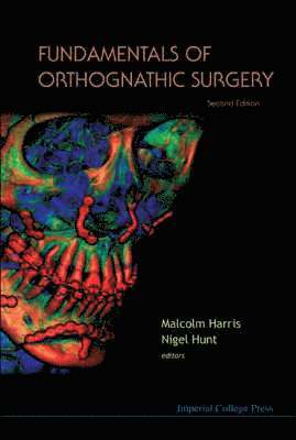 Fundamentals Of Orthognathic Surgery (2nd Edition) 1