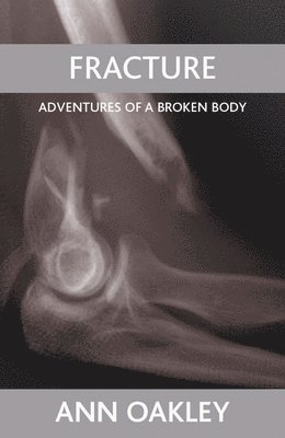 bokomslag Fracture
