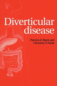 bokomslag Diverticular Disease