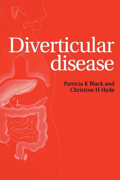 bokomslag Diverticular Disease