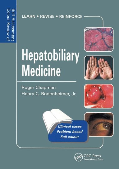 Roger Chapman, Henry Bodenheimer Jr. - Hepatobiliary Medicine, Häftad