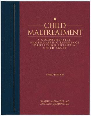 Child Maltreatment 1