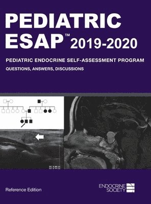 Pediatric ESAP 2019-2020 Pediatric Endocrine Self-Assessment Program 1