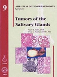 bokomslag Tumors of the Salivary Glands