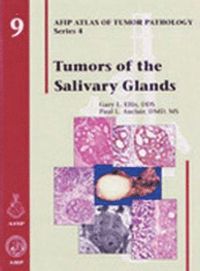 bokomslag Tumors of the Salivary Glands