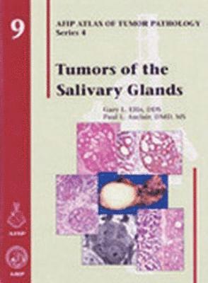 Tumors of the Salivary Glands 1