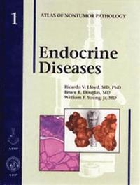 bokomslag Endocrine Diseases