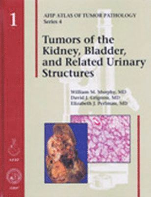 William M. Murphy, David J. Grignon, Elizabeth J. Perlman - Tumors of the Kidney, Bladder, and Related Urinary Structures, Inbunden