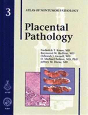 bokomslag Placental Pathology