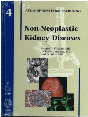 Non-Neoplastic Kidney Diseases 1