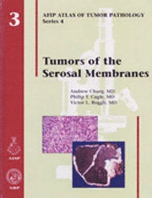 bokomslag Tumors of the Serosal Membranes