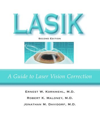 bokomslag Lasik: A Guide to Laser Vision Correction