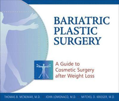 Bariatric Plastic Surgery 1