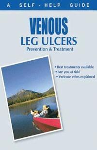 bokomslag The Doctor's Guide to: Venous Leg Ulcers: Prevention and Treatment