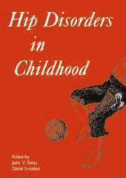 Hip Disorders in Childhood 1