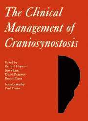 Richard Hayward, Barry Jones - The Clinical Management of Craniosynostosis, Inbunden