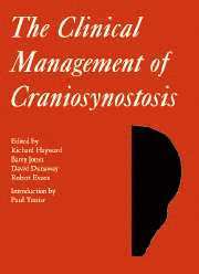 bokomslag The Clinical Management of Craniosynostosis