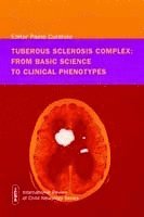 bokomslag Tuberous Sclerosis Complex