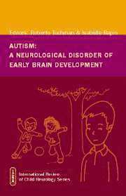 bokomslag Autism: A Neurological Disorder of Early Brain Development