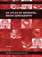 bokomslag An Atlas of Neonatal Brain Sonography