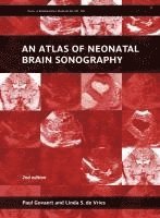 Paul Govaert, Linda S. de Vries, The Netherlands) Govaert, Paul (Sophia Children's Hospital, The Netherlands) de Vries, Linda S. (Wilhelmina Children's Hospital, University Medical Centre, Linda S De Vries - Atlas of Neonatal Brain Sonography, Inbunden