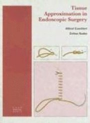 bokomslag Tissue Approximation in Endoscopic Surgery
