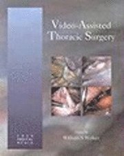 bokomslag Video Assisted Thoracic Surgery