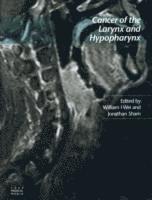 bokomslag Cancer of the Larynx and Hypopharynx