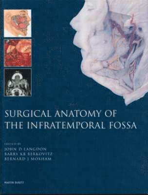 bokomslag Surgical Management of the Infratemporal Fossa