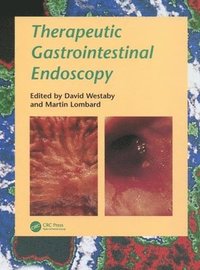 bokomslag Therapeutic Gastrointestinal Endoscopy