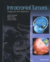 bokomslag Intracranial Tumors