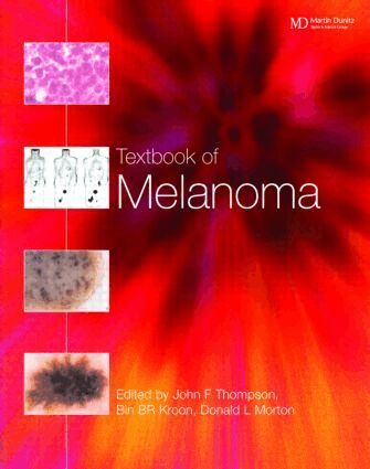 John F. Thompson, Donald L. Morton, Bin B.R. Kroon - Textbook of Melanoma, Inbunden