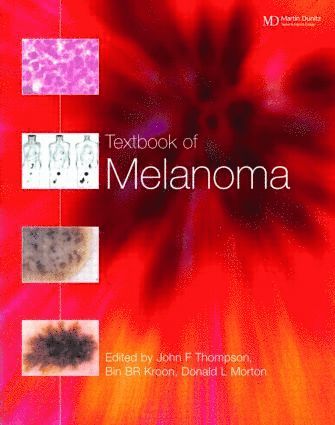 John F. Thompson, Donald L. Morton, Bin B.R. Kroon - Textbook of Melanoma, Inbunden
