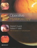 bokomslag Operative Hysteroscopy