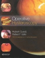 Operative Hysteroscopy 1