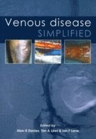 bokomslag Venous Disease Simplified