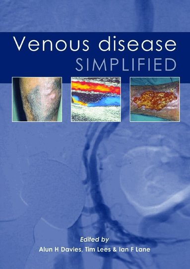 Alun H Davies, Ian Lane, Tim Lees - Venous Disease Simplified, Häftad