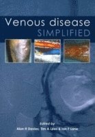 Venous Disease Simplified 1