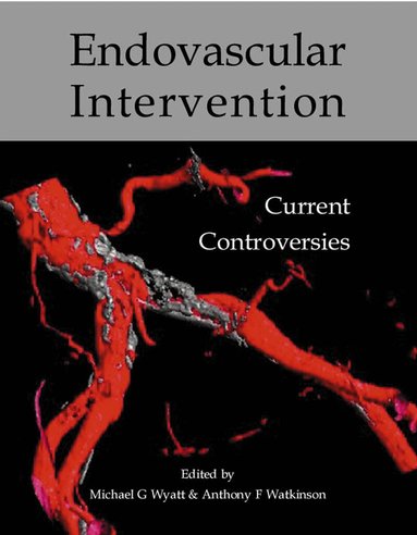 Michael G Wyatt, Anthony F Watkinson - Endovascular intervention, Häftad