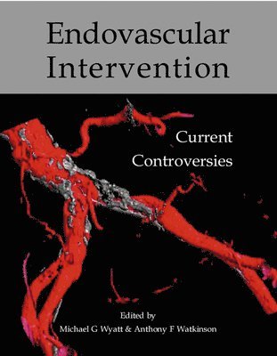 Endovascular intervention 1