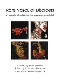 bokomslag Rare Vascular Disorders