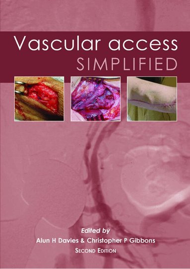 Alun H Davies, Christopher P Gibbons - Vascular Access Simplified; second edition, Häftad